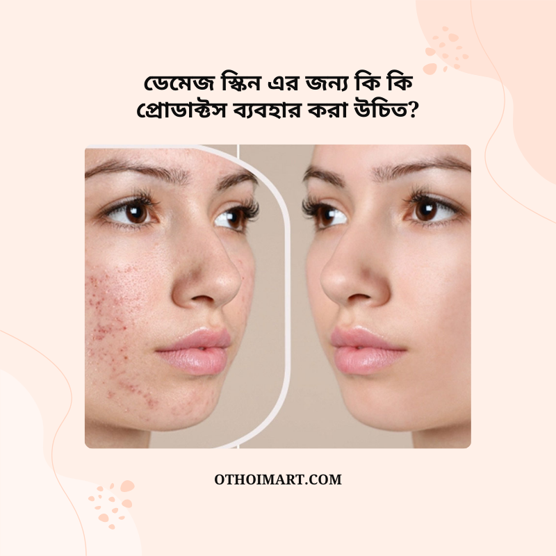 ডেমেজ স্কিন এর জন্য কি কি প্রোডাক্টস ব্যবহার করা উচিত?