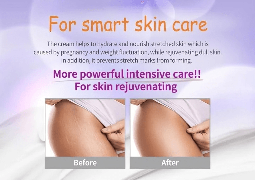 PaxMoly Mom’s Care Stretch Mark Cream 70ml - OthoiMart
