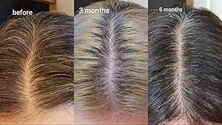 The Ordinary Multi-Peptide Serum for Hair Density 60ml - OthoiMart