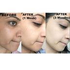 Kojie San Skin Lightening Kojic Acid Soap - OthoiMart