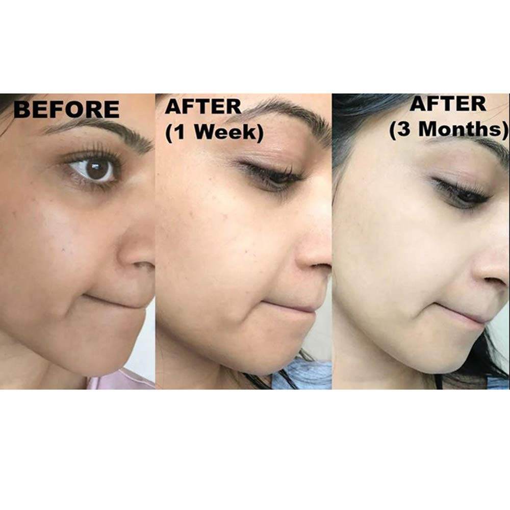 Kojie San Skin Lightening Kojic Acid Soap - OthoiMart