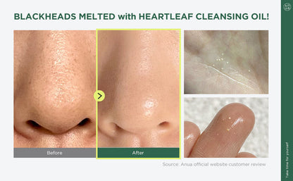 Anua Heartleaf Pore Control Cleansing Oil 200 ml