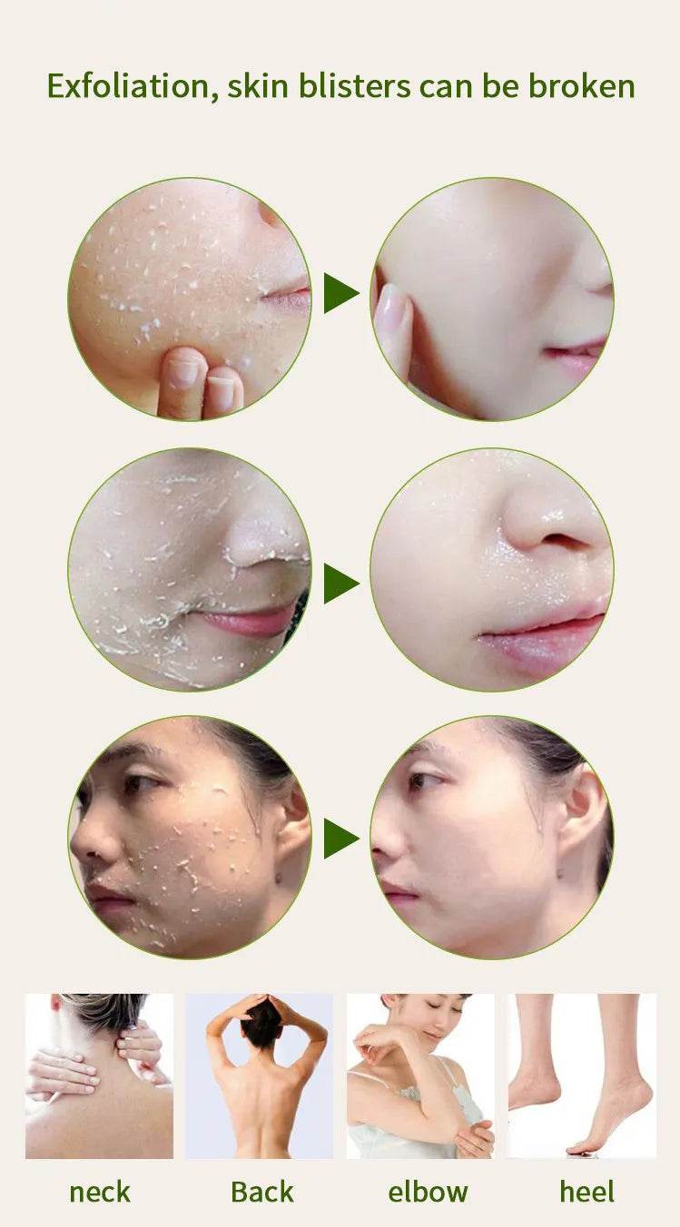 Tomato Peeling Gel Deep Cleansing 320ml - OthoiMart