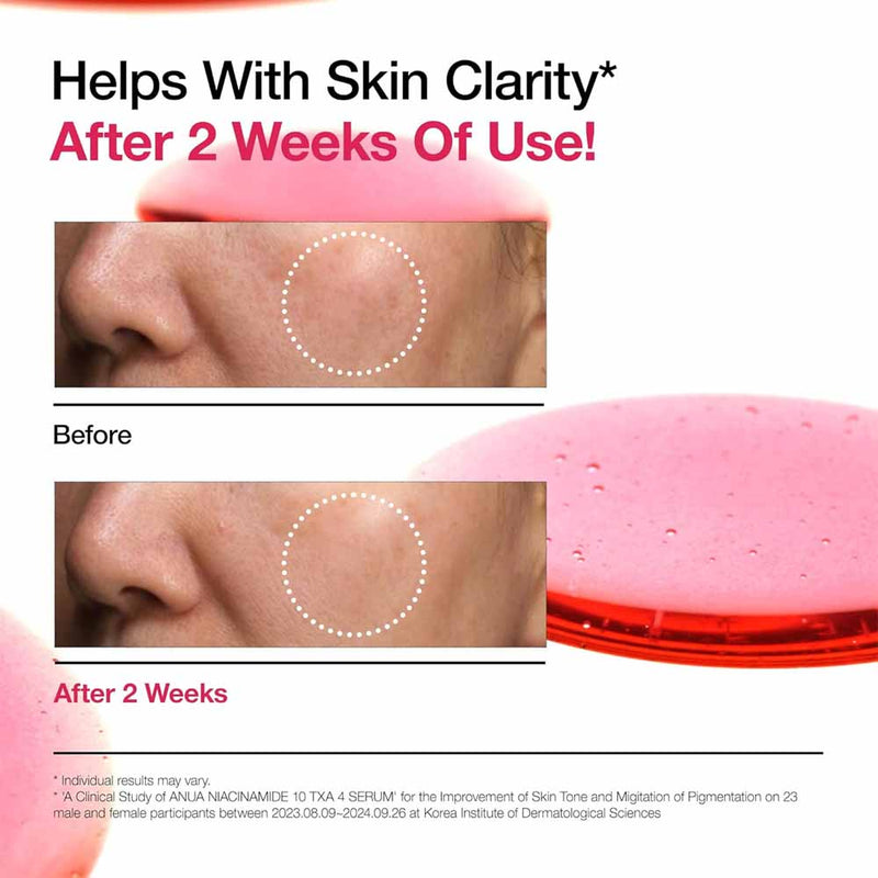 Anua_Niacinamide_10_TXA_4_Serum_10ml_othoimart-Beauty shop-4