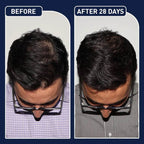 FEG Plus Hair Growth Spray - 50ml | OthoiMart - Beauty Shop | Beauty, cosmetic, Skincare, Haircare & personal care - Beauty Store.