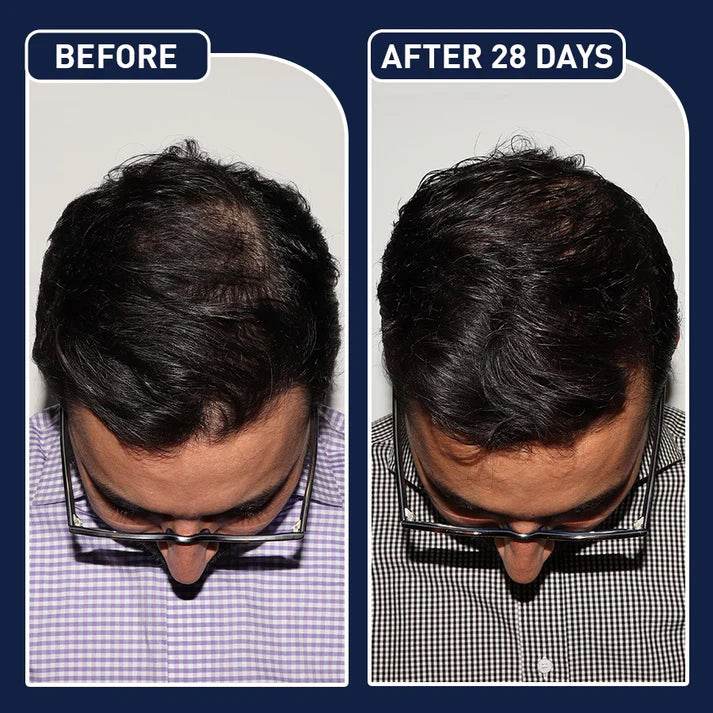 FEG Plus Hair Growth Spray - 50ml | OthoiMart - Beauty Shop | Beauty, cosmetic, Skincare, Haircare & personal care - Beauty Store.