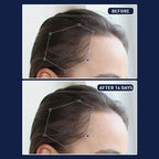 FEG Plus Hair Growth Spray - 50ml | OthoiMart - Beauty Shop | Beauty, cosmetic, Skincare, Haircare & personal care - Beauty Store.