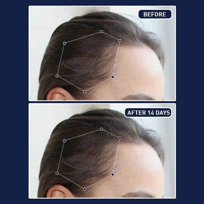 FEG Plus Hair Growth Spray - 50ml | OthoiMart - Beauty Shop | Beauty, cosmetic, Skincare, Haircare & personal care - Beauty Store.