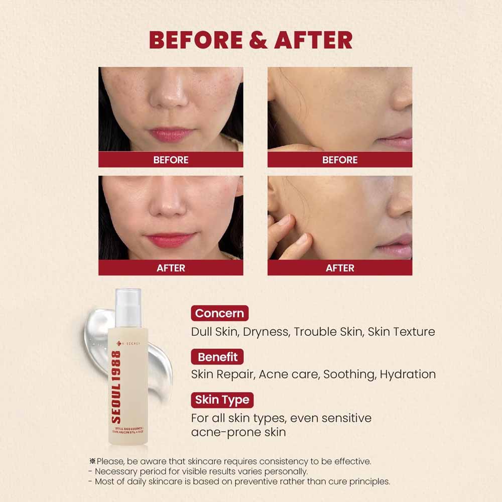 K-SECRET SEOUL 1988 Essence – Snail Mucin 97% + Rice 100ml | Korean Skincare | OthoiMart Beauty Shop