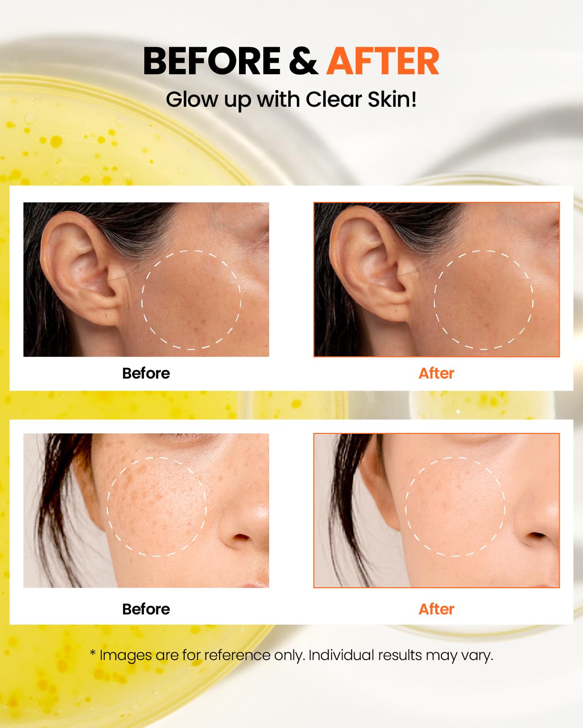 K-SECRET SEOUL 1988 Glow Serum – Niacinamide 15% + Yuja 30ml | OthoiMart Beauty Shop