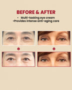 KSECRET SEOUL 1988 Eye Cream 30ml | OthoiMart Beauty Shop