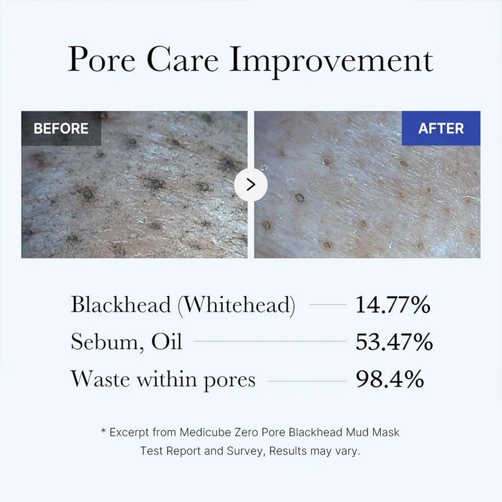 MEDICUBE Zero Pore Blackhead Mud Mask 100g,Korean_Skincare_OthoiMart_Beauty_Shop 04