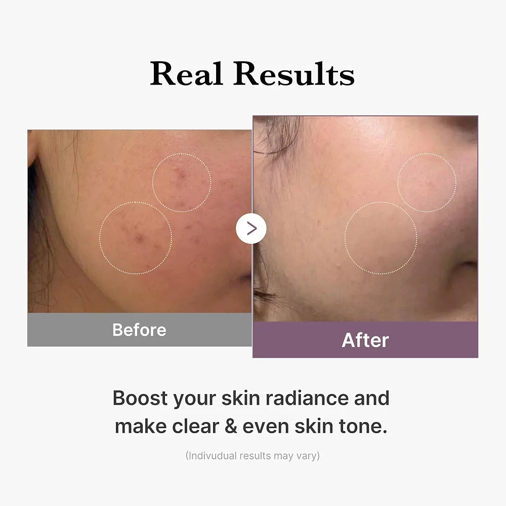 Medicube AGE-R Glutathione Glow Toner 140ml,Korean_Skincare_OthoiMart_Beauty_Shop 04