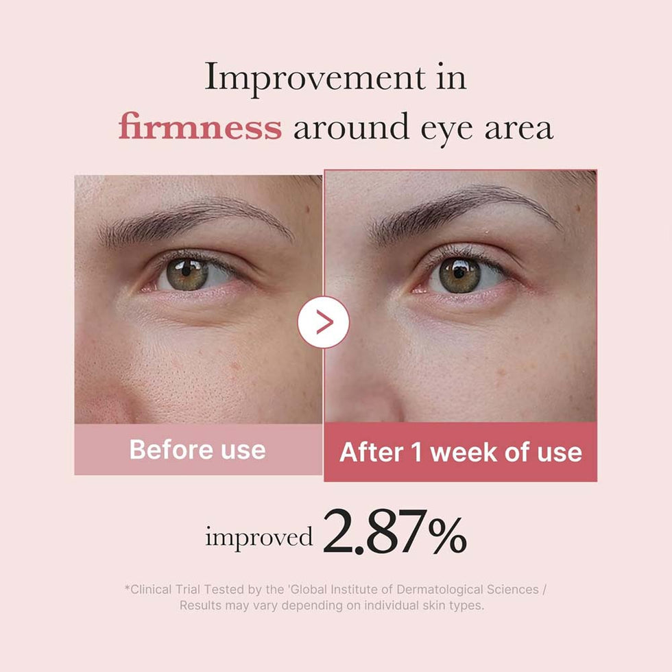 Medicube_PDRN_Pink_Peptide_Eye_Cream_30ml-Korean_Skincare_OthoiMart_Beauty_Shop_05