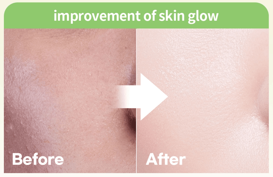 [iUNIK] Centella Calming Gel Cream 60ml - OthoiMart