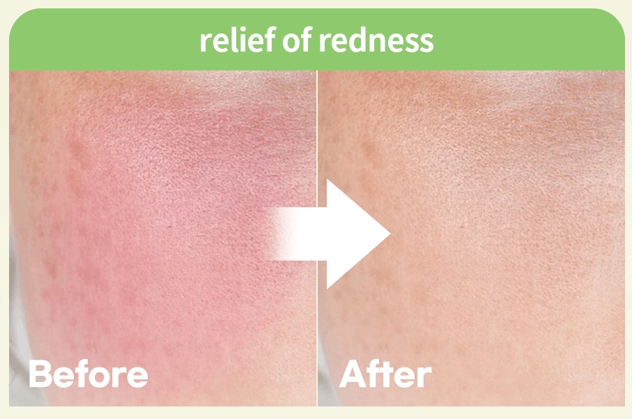 [iUNIK] Centella Calming Gel Cream 60ml - OthoiMart