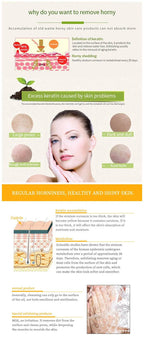 Tomato Peeling Gel Deep Cleansing 320ml - OthoiMart