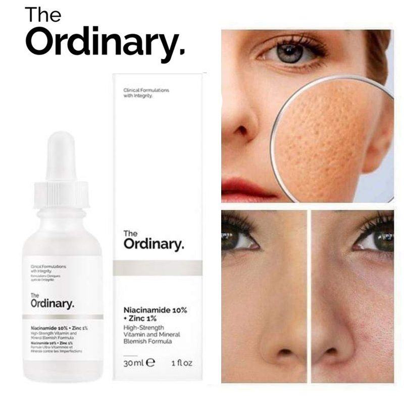 The Ordinary Niacinamide 10% + Zinc 1% 30ml